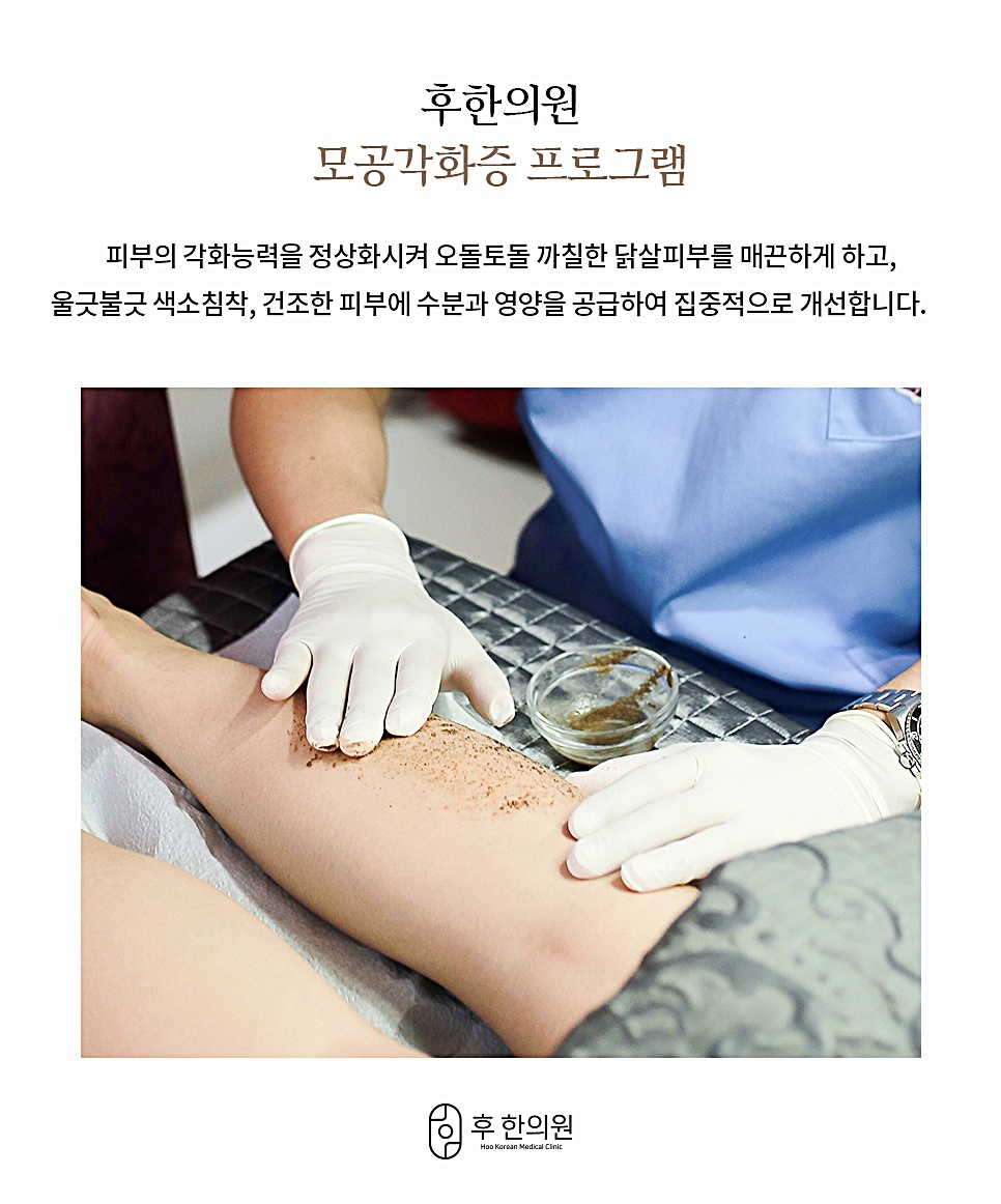 인천 후한의원 모공각화증 프로그램 시술 장면, 후윤약초필링 진행
