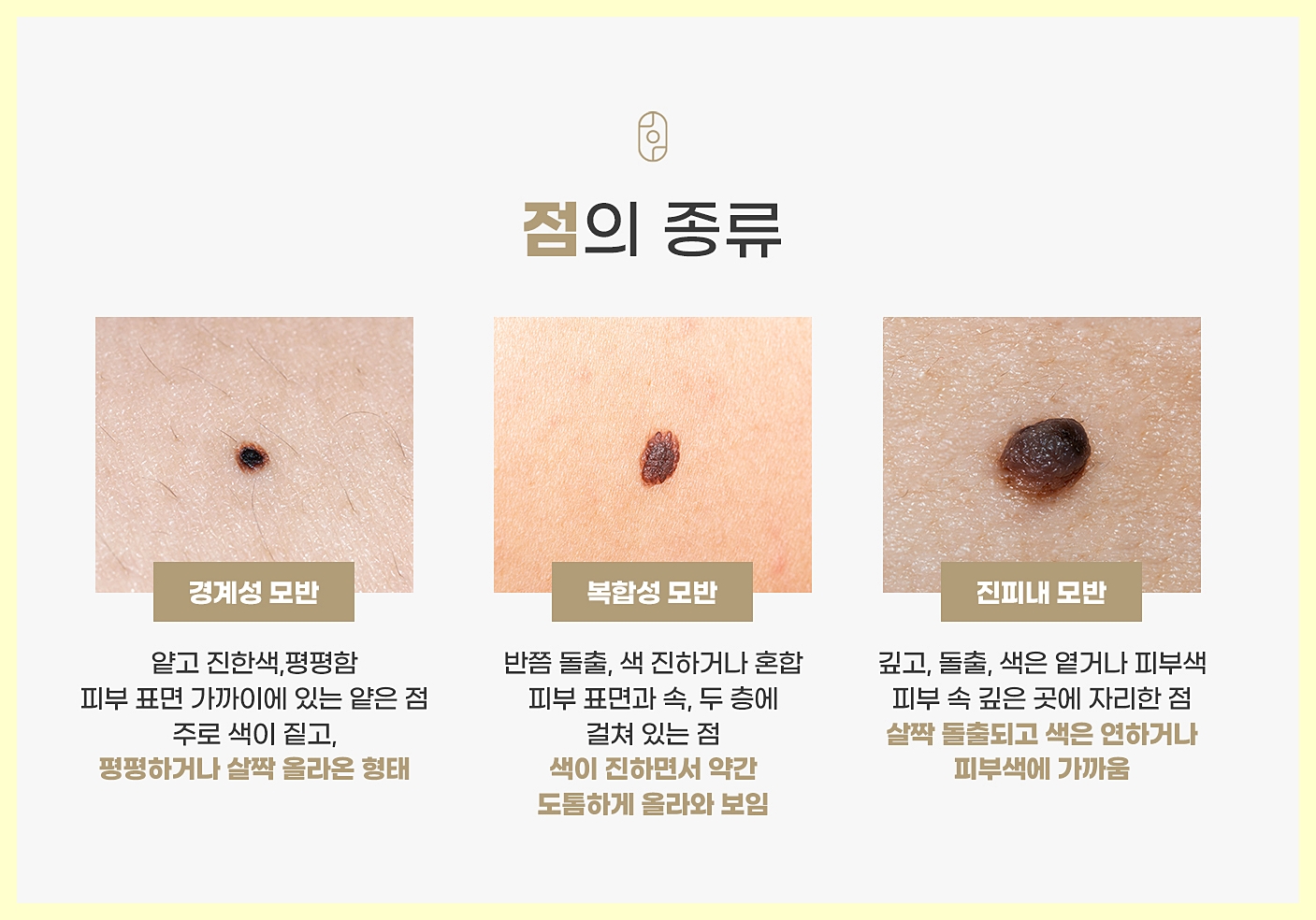 점의 종류를 사진과 함께 특징을 안내하는 이미지