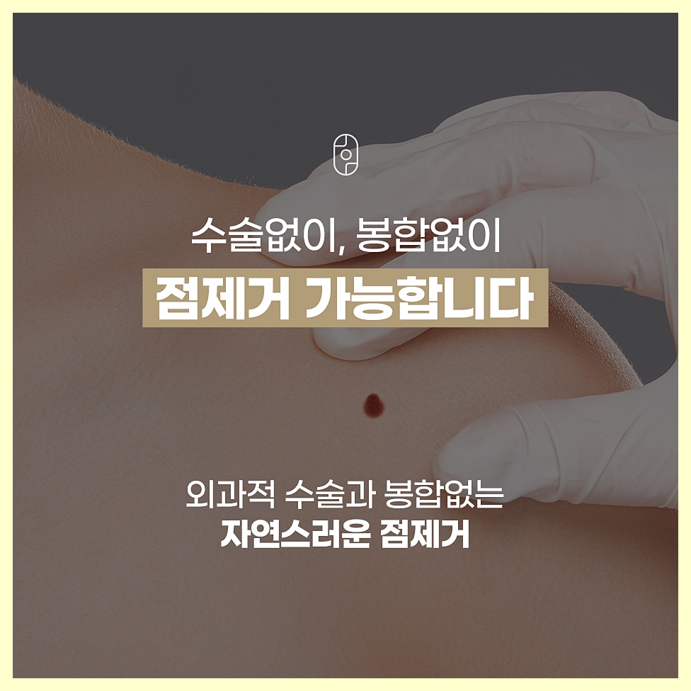 수술없이 봉합 가능한 인천점제거 강조 이미지