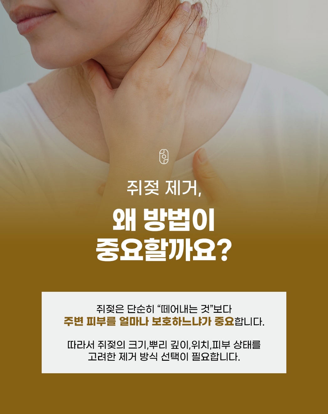 쥐젖 제거 시 주변 피부 보호가 중요한 이유를 설명하는 이미지