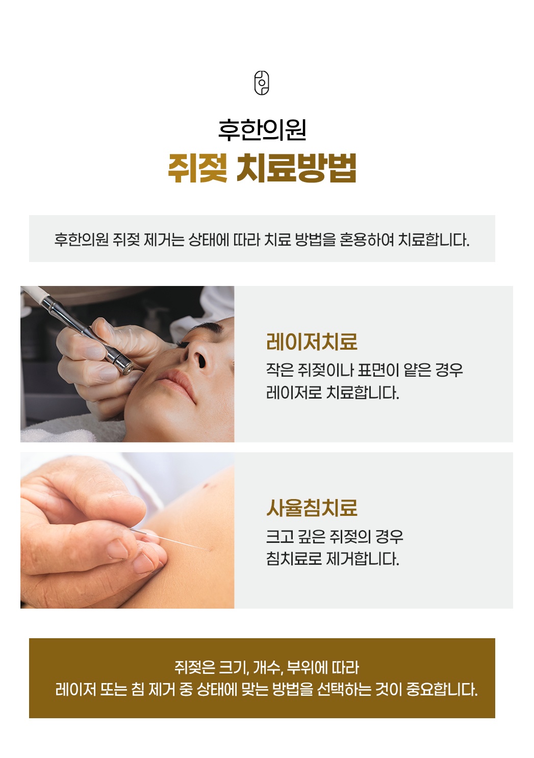 후한의원 쥐젖 치료방법 - 레이저치료와 사율침치료