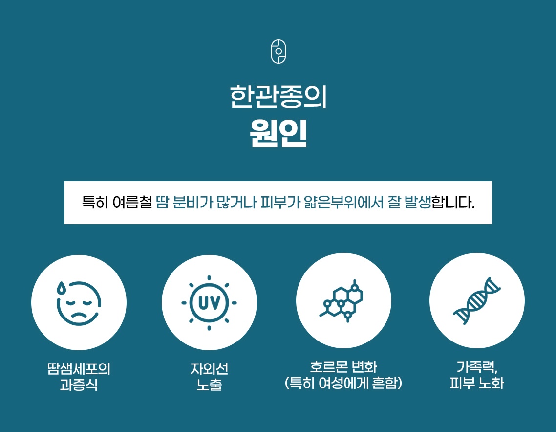 인천한관종 발생 원인 땀샘 과증식 자외선 호르몬 가족력 안내