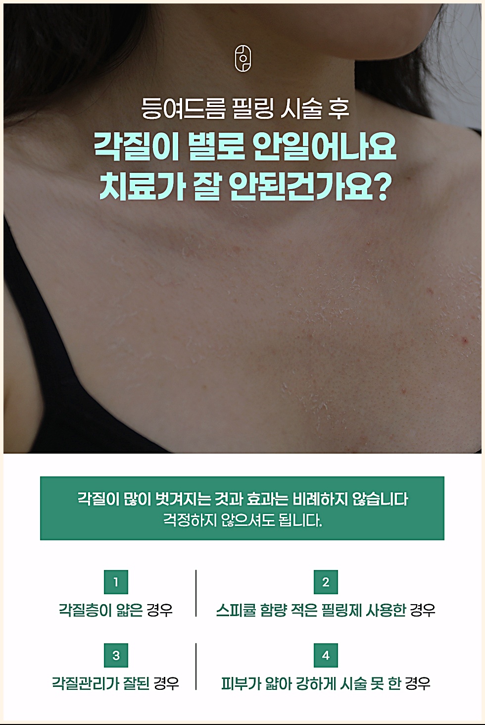 후윤약초필링 시술 후 각질이 적게 일어날 수 있는 이유 4가지 안내