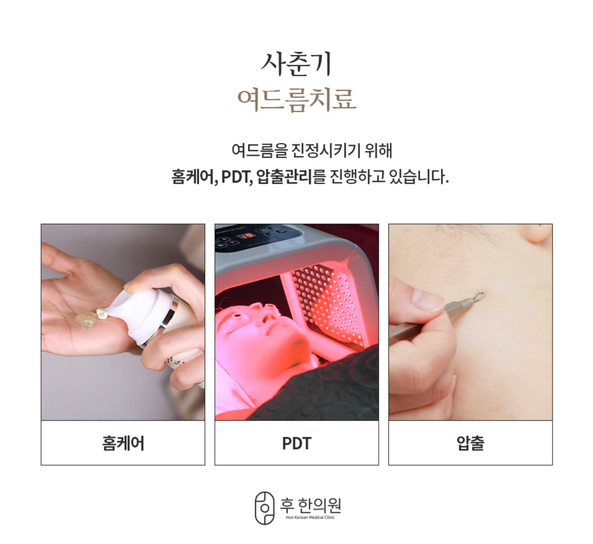 후한의원 사춘기 여드름 치료 과정 (홈케어, PDT, 압출 관리)