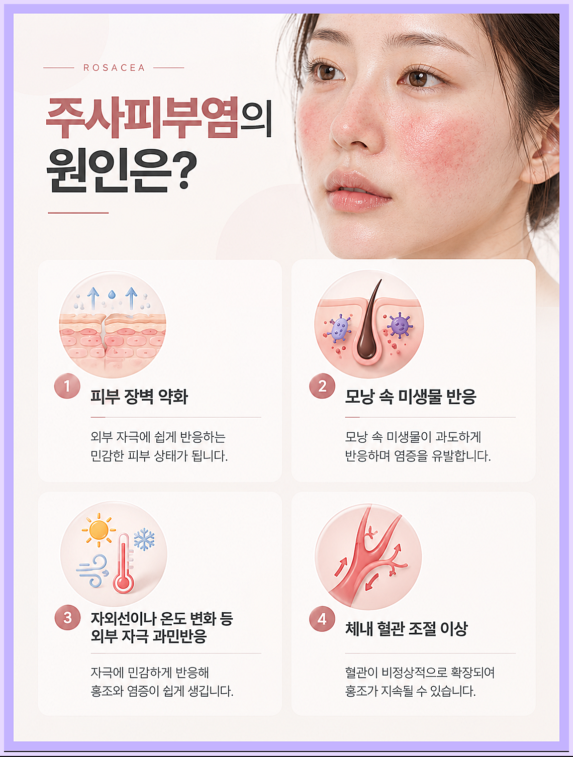 인천주사피부염 원인, 혈관 반응과 면역 반응, 피부 장벽 약화