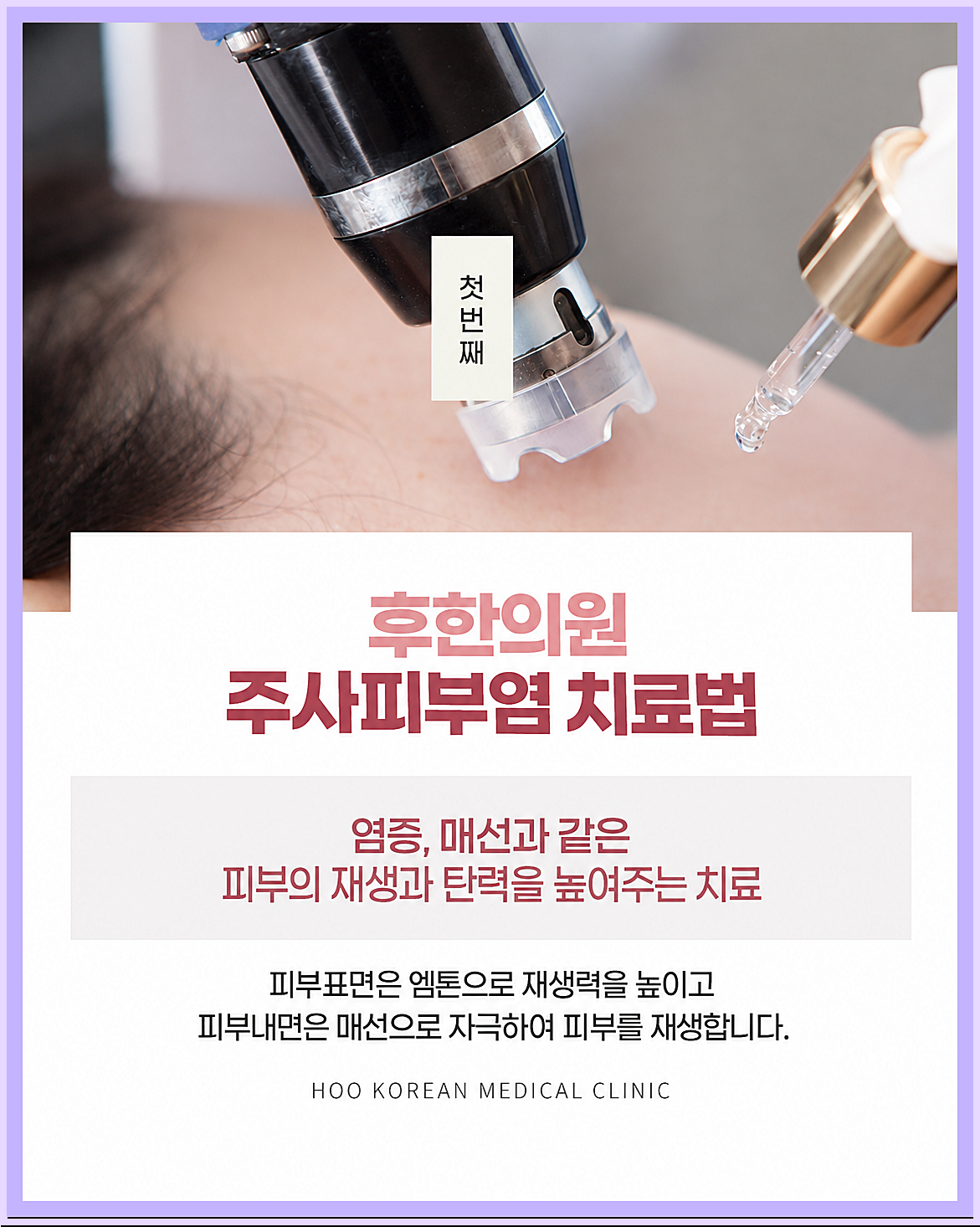인천주사피부염 한의원 치료, 붉은기와 늘어난 혈관을 겨냥하는 엠톤