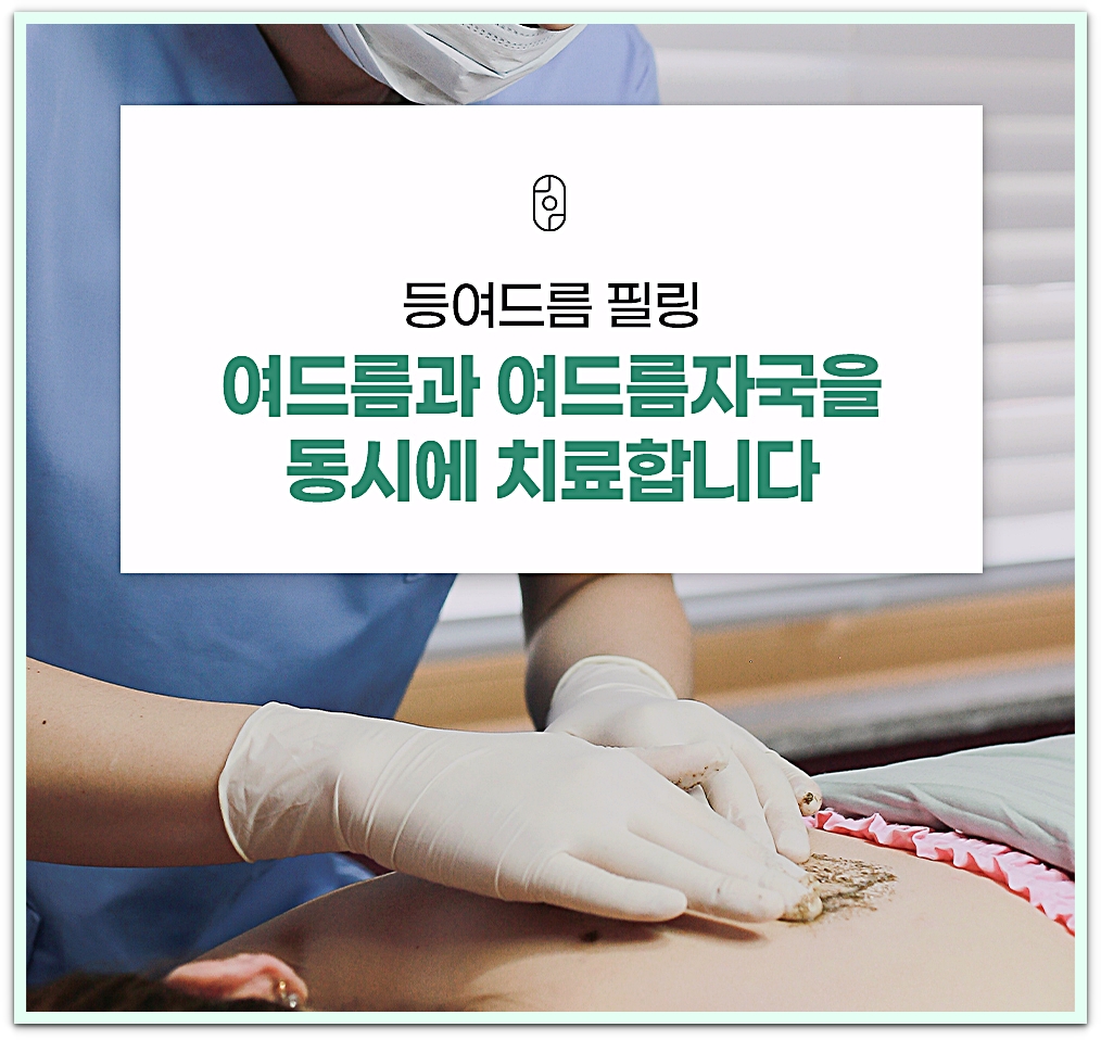 인천등여드름 필링 시술 중 의료진이 등 피부에 필링제를 바르는 모습