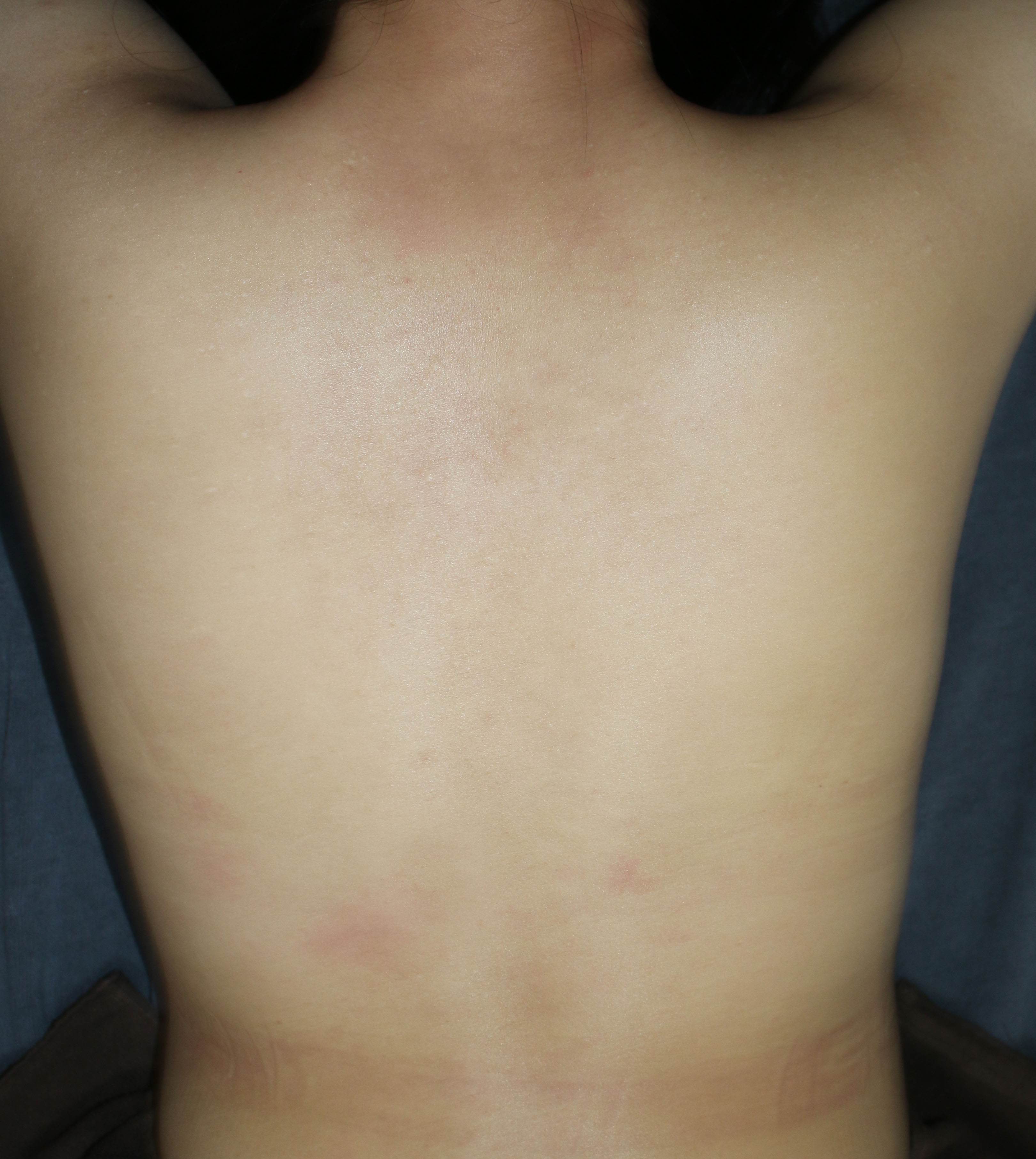 After
