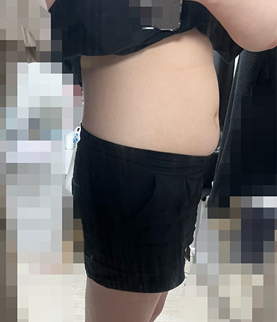 인천 비움탕 3일 다이어트 시작 전 - 후한의원 인천점